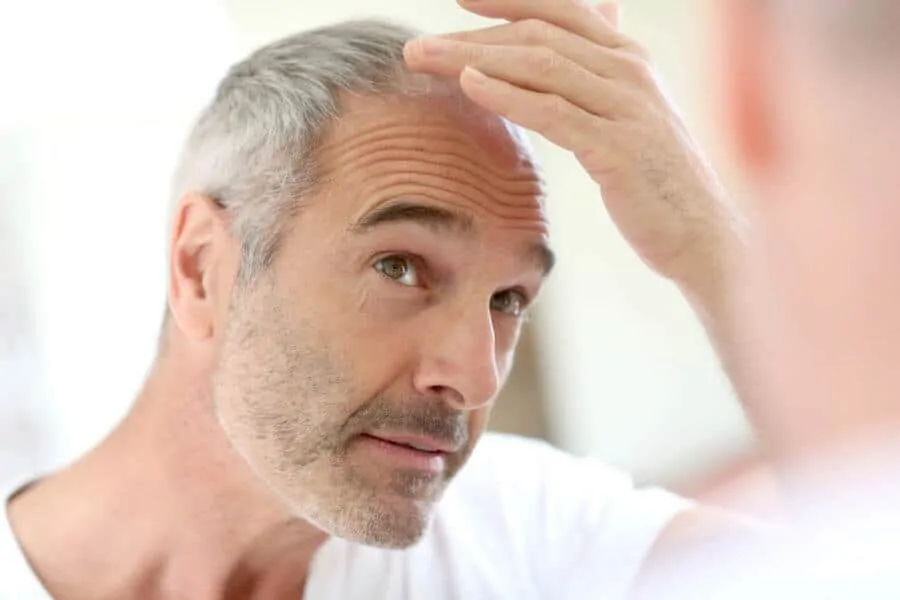 Hair loss issues can be the primary concern