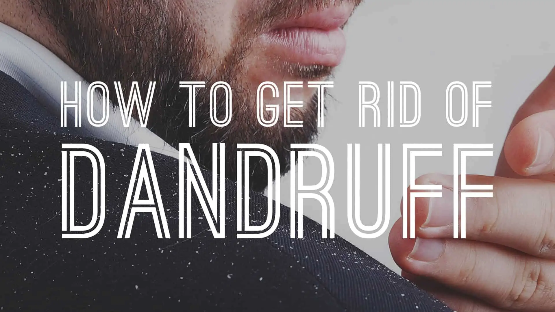 How To Get Rid Of Dandruff and Itchy Scalp