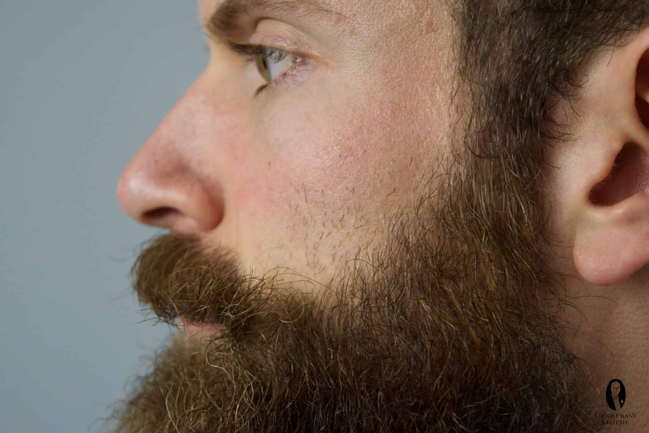 Рост волос на лице у мужчин. Борода. Редкая щетина. Бакенбарды на щеках. Редкая борода.