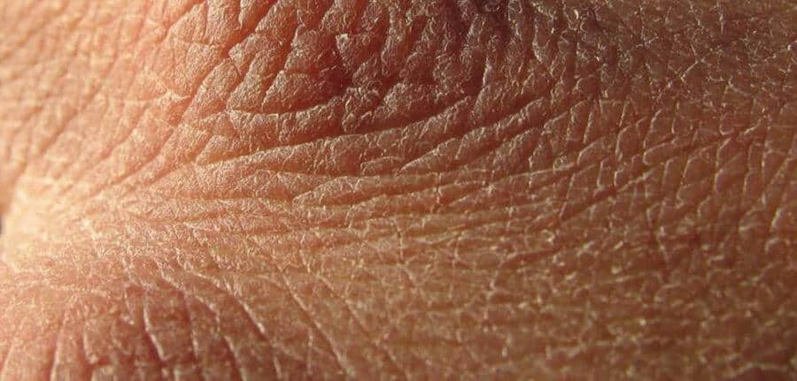 Dry skin close up