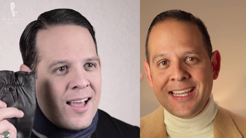 Raphael Then And Now Raphael's hairline - then and now